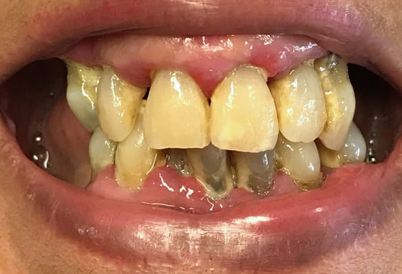 Before - Smile Success