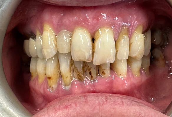 Before - Smile Success